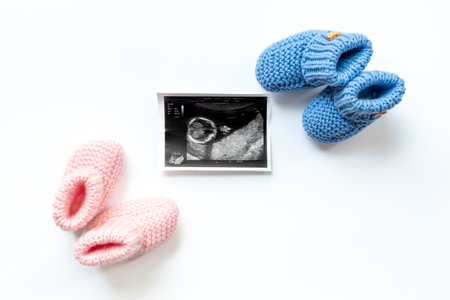 Ultrasound image of a fertilized egg. Planning a baby. Pregnancy and conceiving a child concept.の写真素材