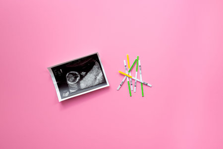 Pregnancy and ovulation tests top view. Female fertility and planning pregnancy concept.