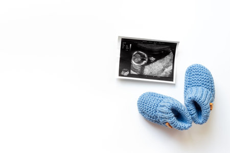 Ultrasound image of a fertilized egg. Planning a baby. Pregnancy and conceiving a child concept.
