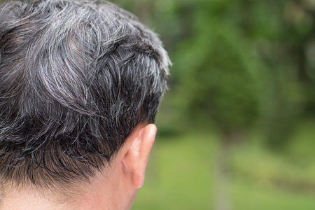 old senior or middle aged man with grey hair problemの写真素材