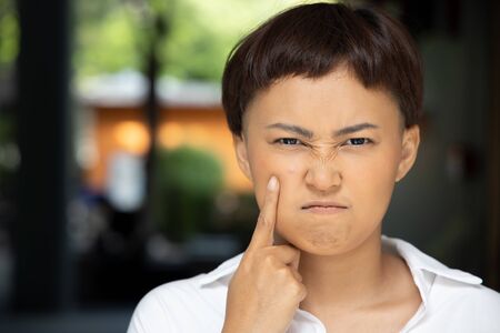 unhappy woman with acne on her cheek face; concept of facial skin care, acne treatment, pimple, zit inflammationの写真素材