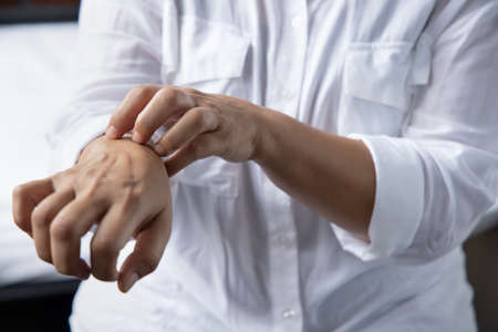 itching woman scratching her hand skin due to scabies, eczema, ringworm, allergic skin, atopic dermatitis symptomsの写真素材