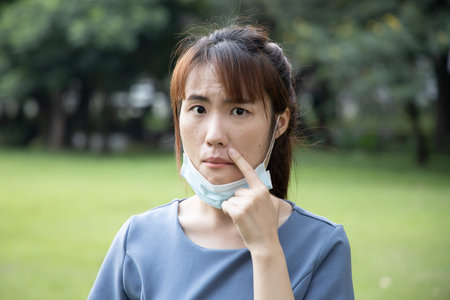 Asian woman tiring of mask and removing face mask in outdoor park due to acne or pimple on her face,...