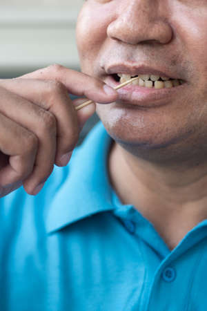 man with crooked teeth using toothpick, concept of oral care, tooth care, bad breathの写真素材
