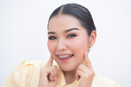 happy smiling woman pointing at teeth braces or orthodontics dental braces, cosmetic dental care conceptの写真素材