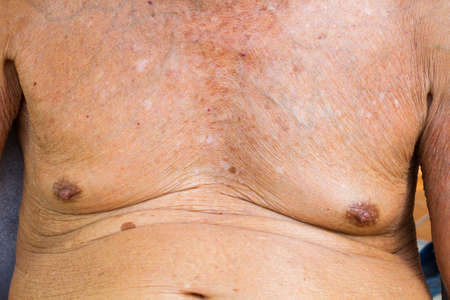 closeup old man chest with texture of wrinkle skinの写真素材