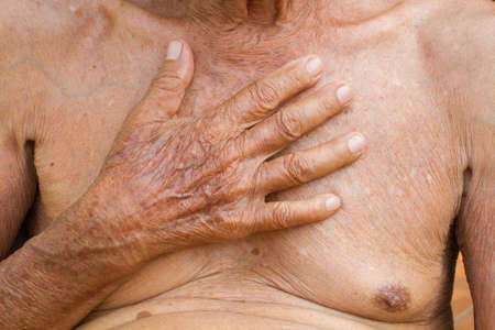 old asian man with health problem action , touching his own chestの写真素材