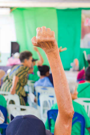 closeup old asian woman suffering from leprosy raise the hand in conference roomの写真素材