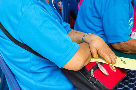 CHIANG RAI, THAILAND - FEBRUARY 19 : Unidentified asian people suffering from leprosy in conference  on February 19, 2016 in Chiang rai, Thailand.のeditorial素材