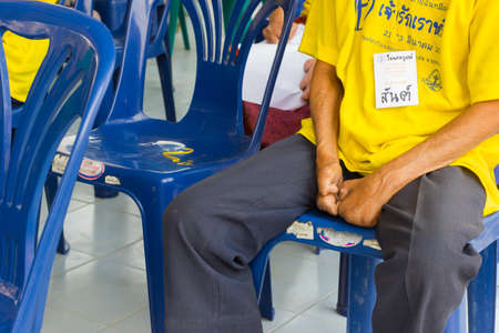 CHIANG RAI, THAILAND - FEBRUARY 19 : Unidentified asian people suffering from leprosy in conference  on February 19, 2016 in Chiang rai, Thailand.のeditorial素材