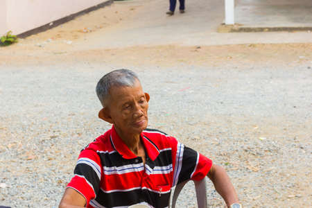 CHIANG RAI, THAILAND - MARCH 20 : unidentified old asian leprosy man with sad mood on March 20, 2016 in Chiang rai, Thailand.のeditorial素材