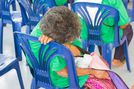 CHIANG RAI, THAILAND - FEBRUARY 19 : Unidentified sleepy old asian woman suffering from leprosy on February 19, 2016 in Chiang rai, Thailand.のeditorial素材