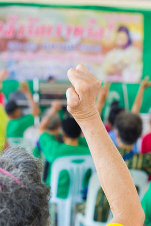 closeup old asian woman suffering from leprosy raise the hand in conference room