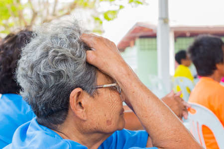 CHIANG RAI, THAILAND - FEBRUARY 19 : Unidentified old asian woman suffering from leprosy on February 19, 2016 in Chiang rai, Thailand.のeditorial素材
