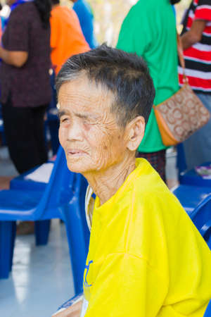 CHIANG RAI, THAILAND - FEBRUARY 19 : Unidentified old asian woman suffering from leprosy on February 19, 2016 in Chiang rai, Thailand.のeditorial素材