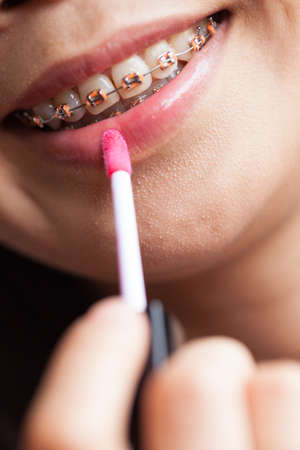 woman make up lipstick mouth.woman braces make up lipstick on mouth.