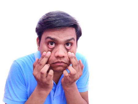 Man open eyes by hand looking into cameraの写真素材