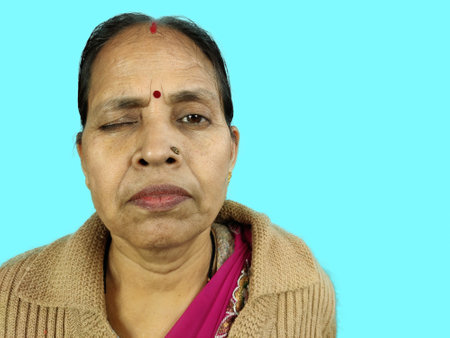 Old Indian woman close one eye due to eye operation cataract bad eyesight.の写真素材