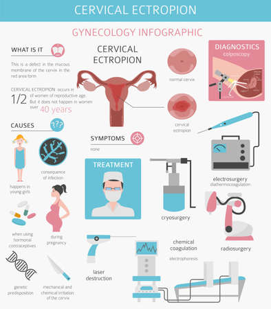 Cervical ectropion. Ginecological medical desease infographic. Vector illustrationのイラスト素材
