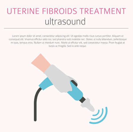 Uterine fibroids. Ginecological medical desease in women infographic. Vector illustrationのイラスト素材