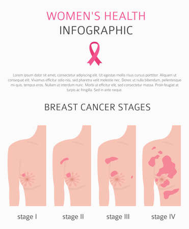 Breast cancer, medical infographic. Diagnostics, symptoms, treatment. Women`s health set. Vector illustrationのイラスト素材