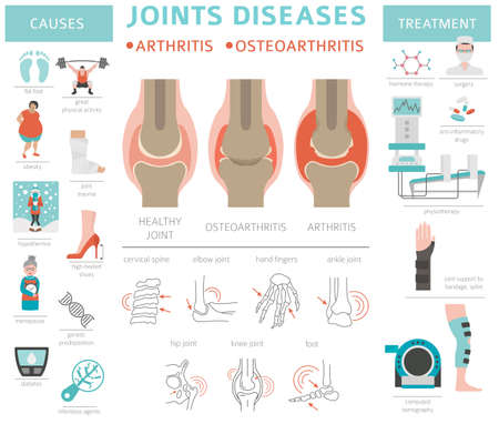 Joints diseases. Arthritis, osteoarthritis symptoms, treatment icon set. Medical infographic design. Vector illustrationのイラスト素材