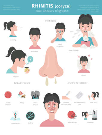 Nasal diseases. Rhinitis symptoms, treatment icon set. Medical infographic design. Vector illustrationのイラスト素材