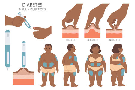 Diabetes. Endocrine diseases. Medical infographic design. Vector illustrationのイラスト素材