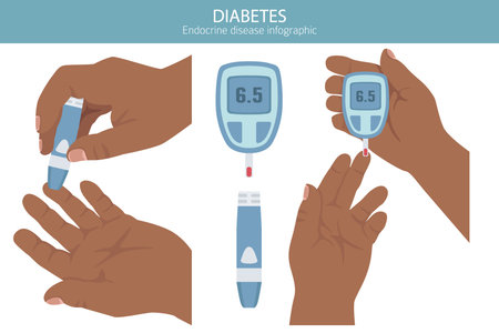 Diabetes. Endocrine diseases. Medical infographic design. Vector illustrationのイラスト素材