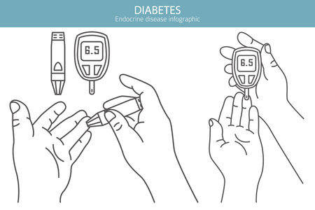 Diabetes. Endocrine diseases. Medical infographic design. Vector illustrationのイラスト素材