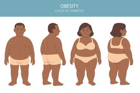 Flat vector illustration of weight loss concept. Before and after body transformation of overweight man and woman. Obese male and female characters shown with slimmer bodies after dieting or fitness. Healthy lifestyle, obesity treatment, fat to fit transition, medical or fitness infographicのイラスト素材
