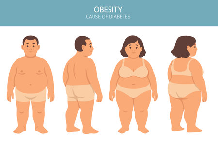 Flat vector illustration of weight loss concept. Before and after body transformation of overweight man and woman. Obese male and female characters shown with slimmer bodies after dieting or fitness. Healthy lifestyle, obesity treatment, fat to fit transition, medical or fitness infographicのイラスト素材