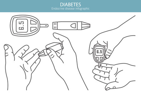 Diabetes. Endocrine diseases. Medical infographic design. Vector illustrationのイラスト素材
