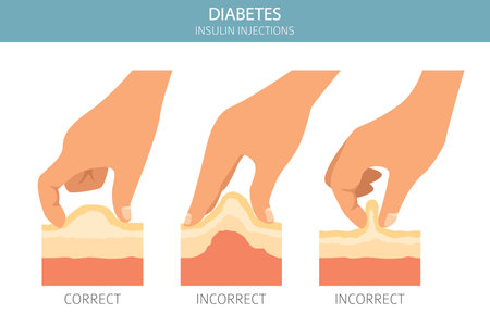 Diabetes. Endocrine diseases. Medical infographic design. Vector illustrationのイラスト素材