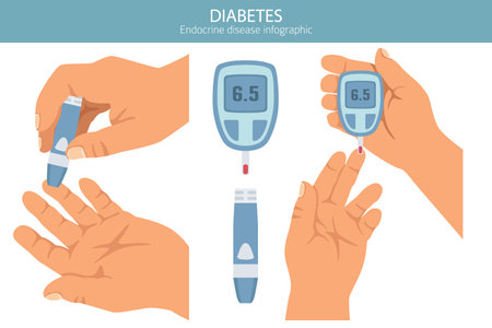 Diabetes. Endocrine diseases. Medical infographic design. Vector illustrationのイラスト素材