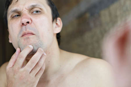 the man squeezes out a pimple on his face. the guy looks in the mirror. morning treatments in the bathroom. copyspaceの写真素材