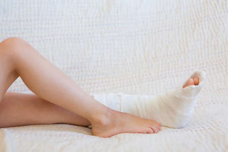broken leg. Close-up of the cast on the feet. exercises to repair and strengthen muscles. damage to the bones. medical care of a surgeon in the emergency roomの写真素材