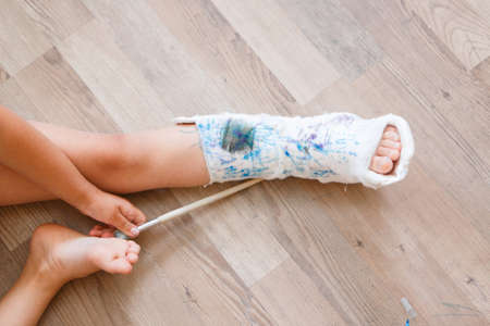 broken leg. damage to the bones. a child paints a plaster. a girl with a markerの写真素材