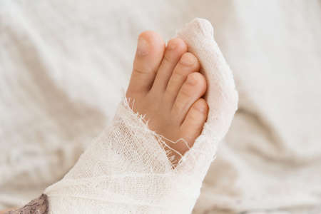 broken leg. Close-up of the cast on the feet. exercises to repair and strengthen muscles. damage to the bones. medical care of a surgeon in the emergency roomの写真素材