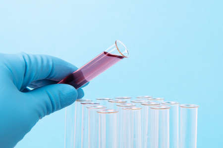 Transfusion of a chemical liquid from a tube into a test tube