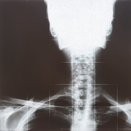X-Rays resonance imaging. Spinal column detail. Medical procedure diagnosis. Radiologyの写真素材