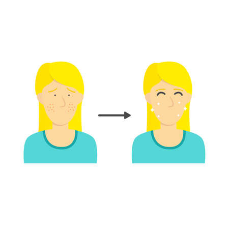 Blonde Woman or girl from acne face to clean face diagram infographic illustrationのイラスト素材