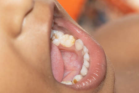 baby smile close. white teeth of a child isolated