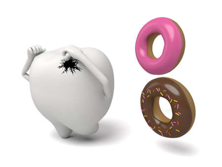 Tooth decayの写真素材