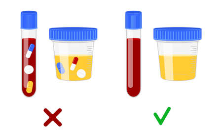 Blood and urine samples with and without different drugs. Doping control in sport, post accident drug testing concept. Vector cartoon illustration.のイラスト素材