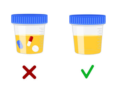 Urinalysis, urine samples with and without drugs. Doping control in sport, post accident drug testing concept. Vector cartoon illustration.のイラスト素材