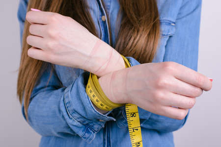Cropped closeup photo of unhappy sad upset depressed stressful crazy she her lady showing holding hands with red marks on white skin isolated grey backgroundの写真素材