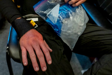 KYLE KIRKWOOD (14) (R) of Jupiter, Florida shows off his swollen hand before the Chevrolet Detroit...