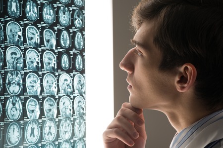 male doctor looking at the x-ray image attached to the glowing screenの写真素材