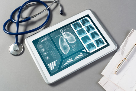 White tablet pc and doctor tools on gray surfaceの写真素材